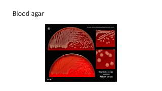 Blood agar
 