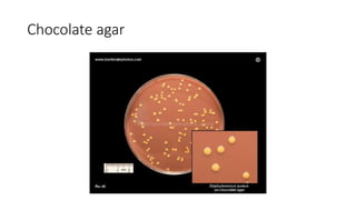 Chocolate agar
 
