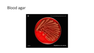 Blood agar
 