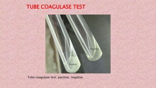 TUBE COAGULASE TEST
Tube coagulase test: positive, negative
 