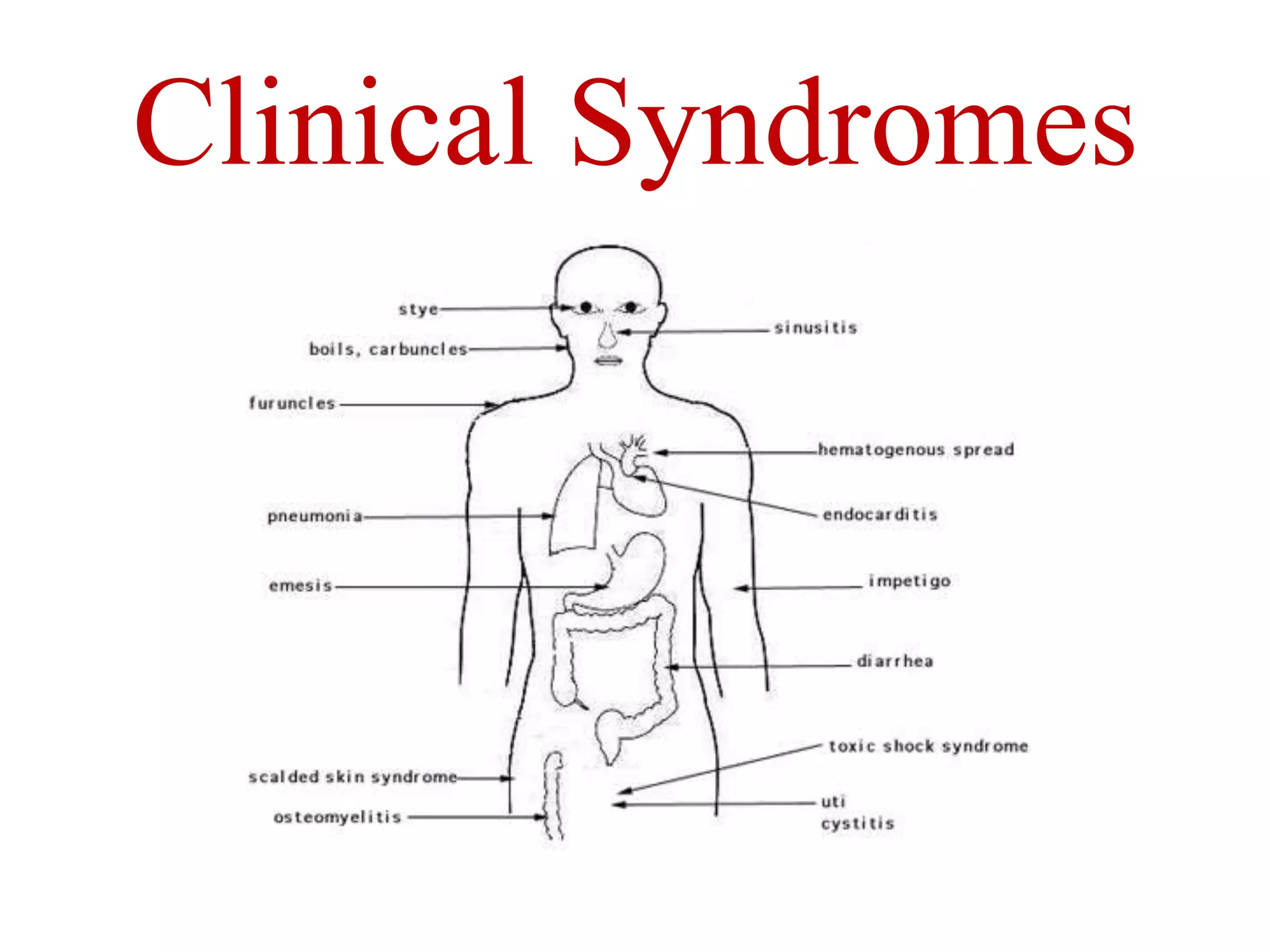Clinical Syndromes
 