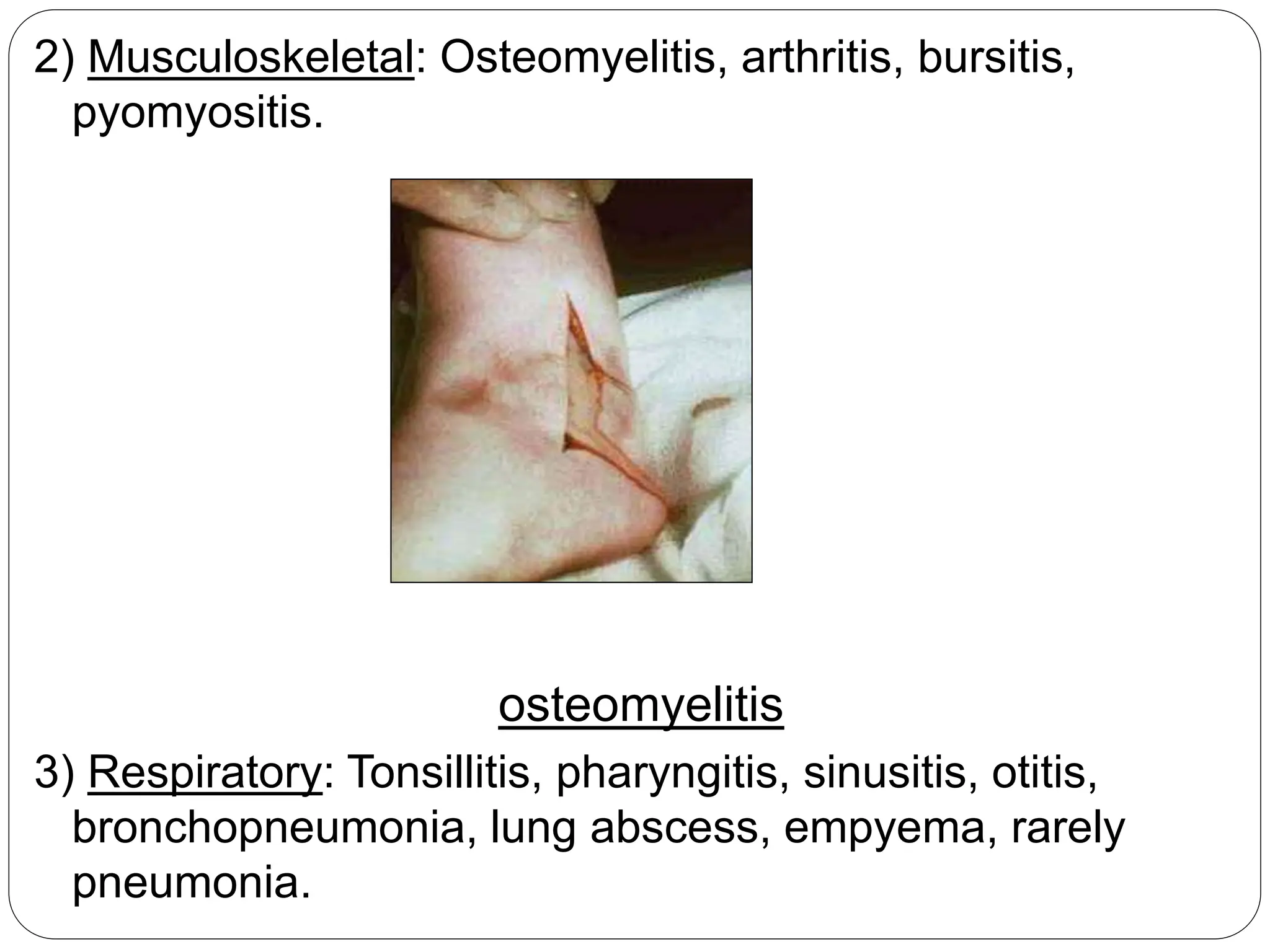 2) Musculoskeletal: Osteomyelitis, arthritis, bursitis,
pyomyositis.
osteomyelitis
3) Respiratory: Tonsillitis, pharyngitis, sinusitis, otitis,
bronchopneumonia, lung abscess, empyema, rarely
pneumonia.
 