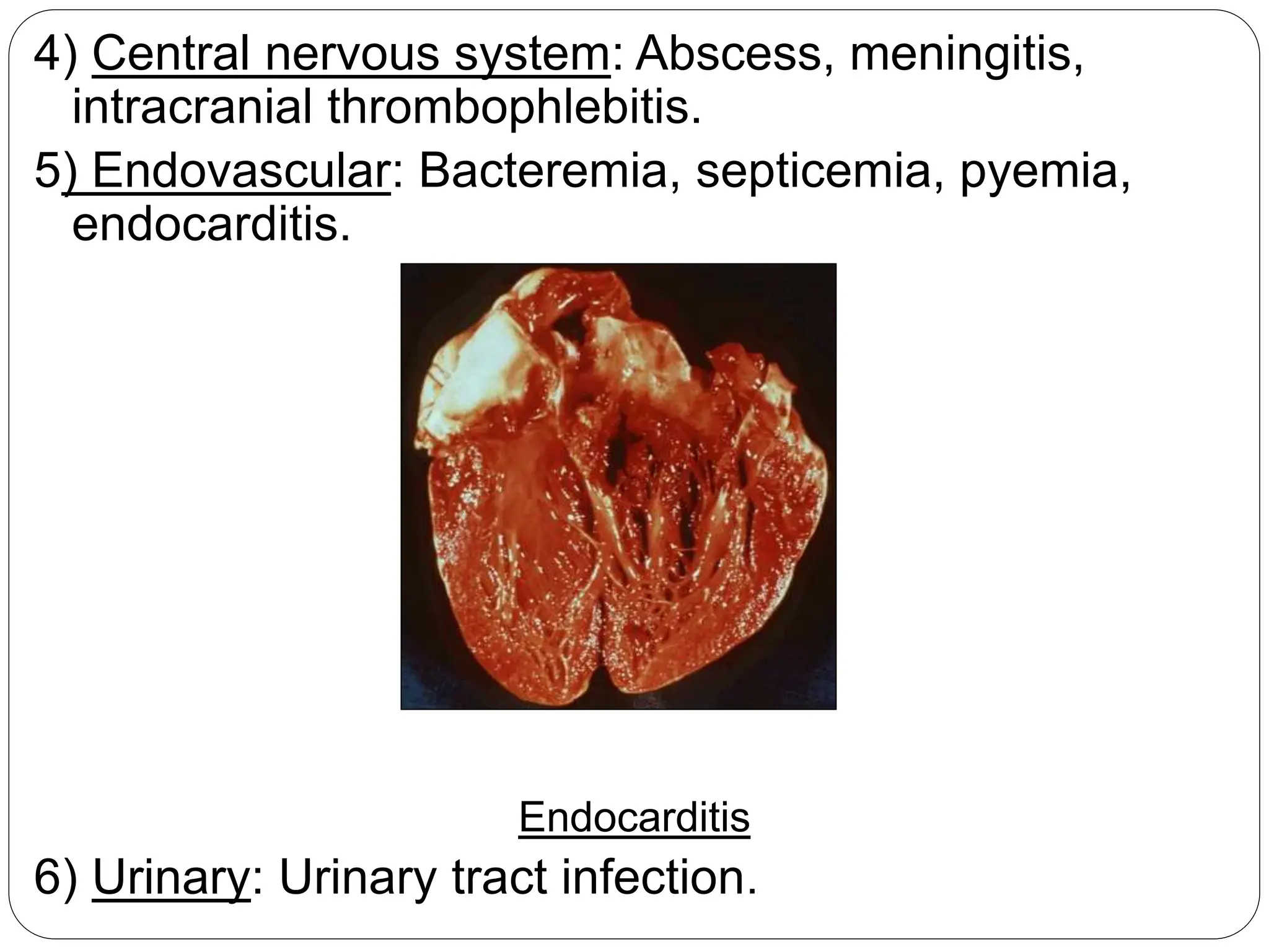 4) Central nervous system: Abscess, meningitis,
intracranial thrombophlebitis.
5) Endovascular: Bacteremia, septicemia, pyemia,
endocarditis.
Endocarditis
6) Urinary: Urinary tract infection.
 