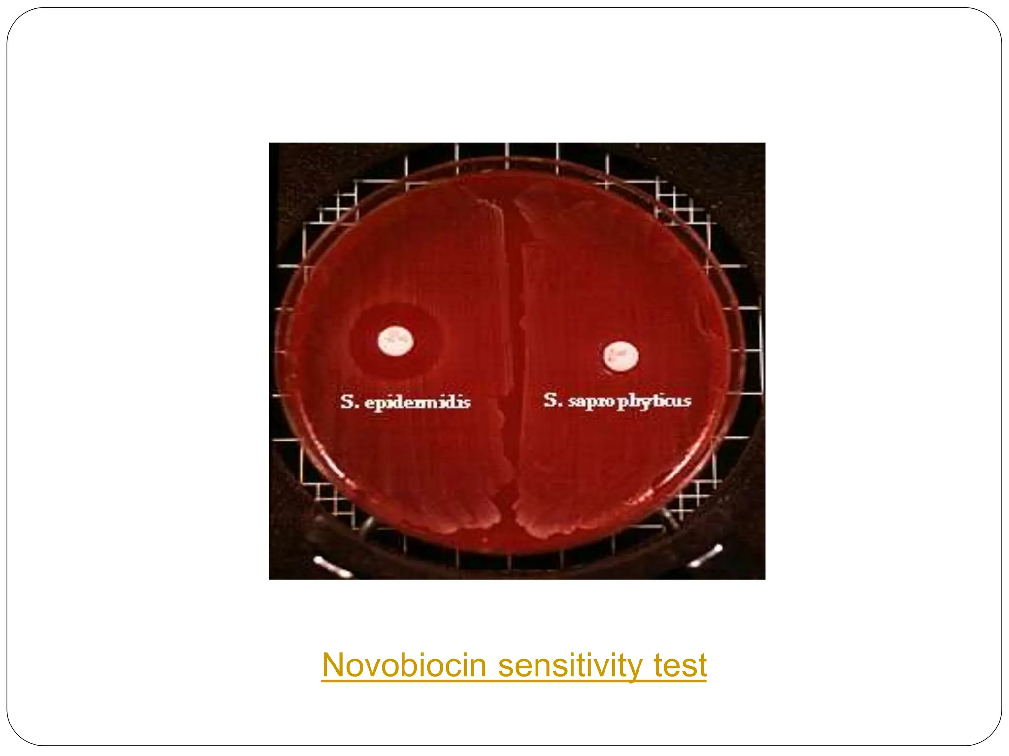 Novobiocin sensitivity test
 