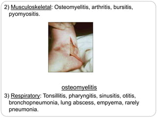 2) Musculoskeletal: Osteomyelitis, arthritis, bursitis,
pyomyositis.
osteomyelitis
3) Respiratory: Tonsillitis, pharyngitis, sinusitis, otitis,
bronchopneumonia, lung abscess, empyema, rarely
pneumonia.
 
