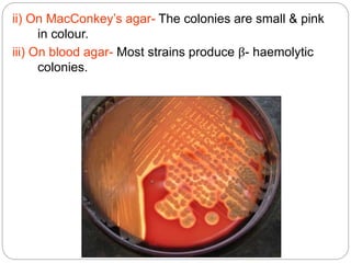 ii) On MacConkey’s agar- The colonies are small & pink
in colour.
iii) On blood agar- Most strains produce β- haemolytic
colonies.
 