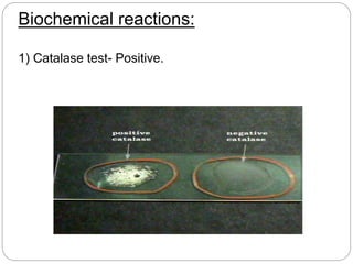 Biochemical reactions:
1) Catalase test- Positive.
 
