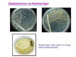 Staphylococcus on Nutrient Agar
Nutrient agar: white, yellow, or orange
water-soluble pigments
 