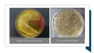 Staphylococcus aureus in Mannitol Salt Agar S. aureus on Baird-Parker agar plate
 