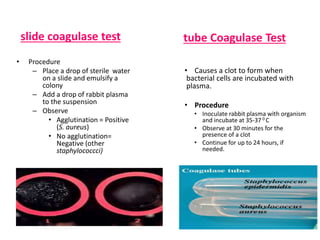 How to identify Staphylococcus aureus using the Coagulase Test - Slide and  Tube Method - 4K 