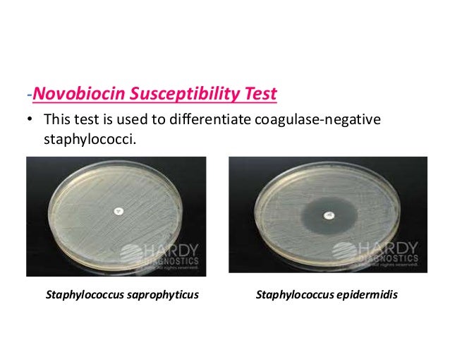 Staphylococcus Aureus - 638x479 - jpeg S Saprophyticus Novobiocin