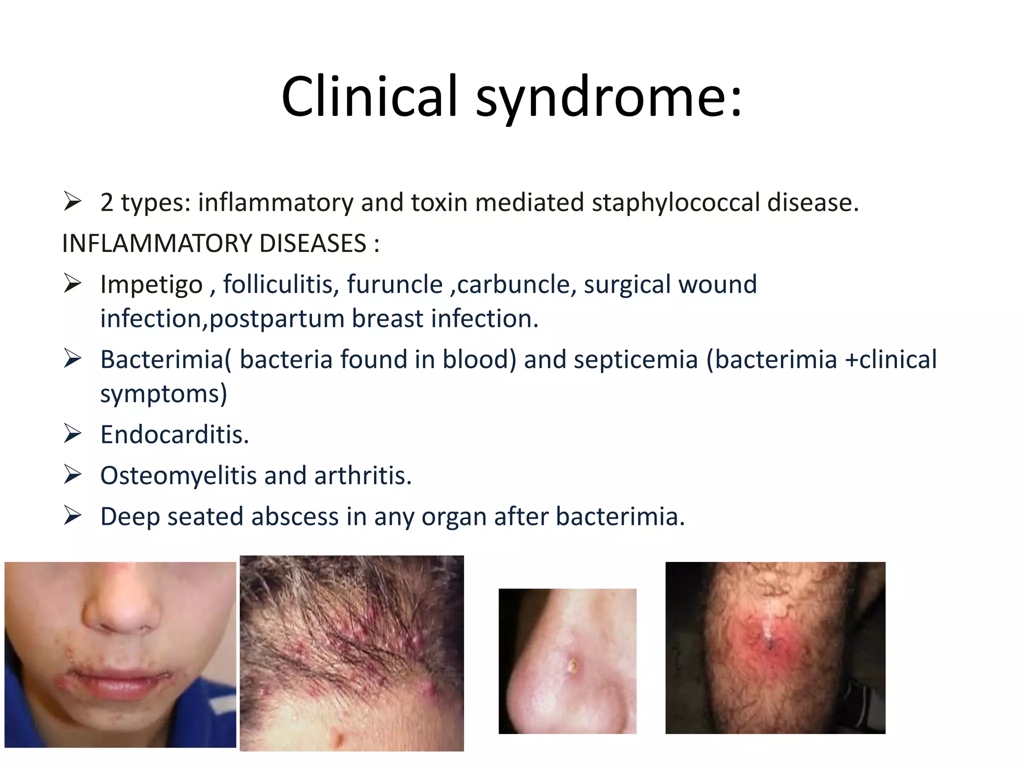 Clinical syndrome:
➢ 2 types: inflammatory and toxin mediated staphylococcal disease.
INFLAMMATORY DISEASES :
➢ Impetigo , folliculitis, furuncle ,carbuncle, surgical wound
infection,postpartum breast infection.
➢ Bacterimia( bacteria found in blood) and septicemia (bacterimia +clinical
symptoms)
➢ Endocarditis.
➢ Osteomyelitis and arthritis.
➢ Deep seated abscess in any organ after bacterimia.
 