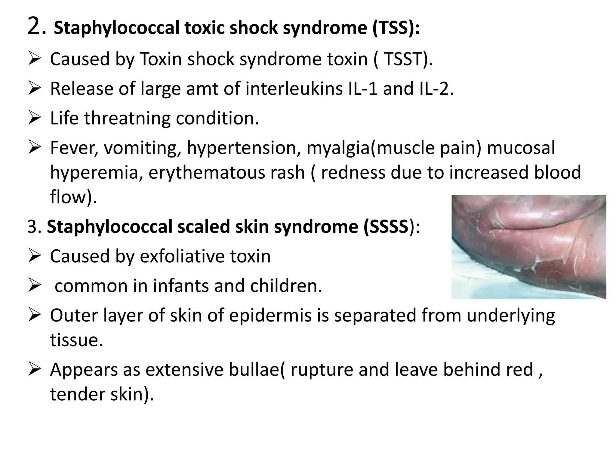 2. Staphylococcal toxic shock syndrome (TSS):
➢ Caused by Toxin shock syndrome toxin ( TSST).
➢ Release of large amt of interleukins IL-1 and IL-2.
➢ Life threatning condition.
➢ Fever, vomiting, hypertension, myalgia(muscle pain) mucosal
hyperemia, erythematous rash ( redness due to increased blood
flow).
3. Staphylococcal scaled skin syndrome (SSSS):
➢ Caused by exfoliative toxin
➢ common in infants and children.
➢ Outer layer of skin of epidermis is separated from underlying
tissue.
➢ Appears as extensive bullae( rupture and leave behind red ,
tender skin).
 