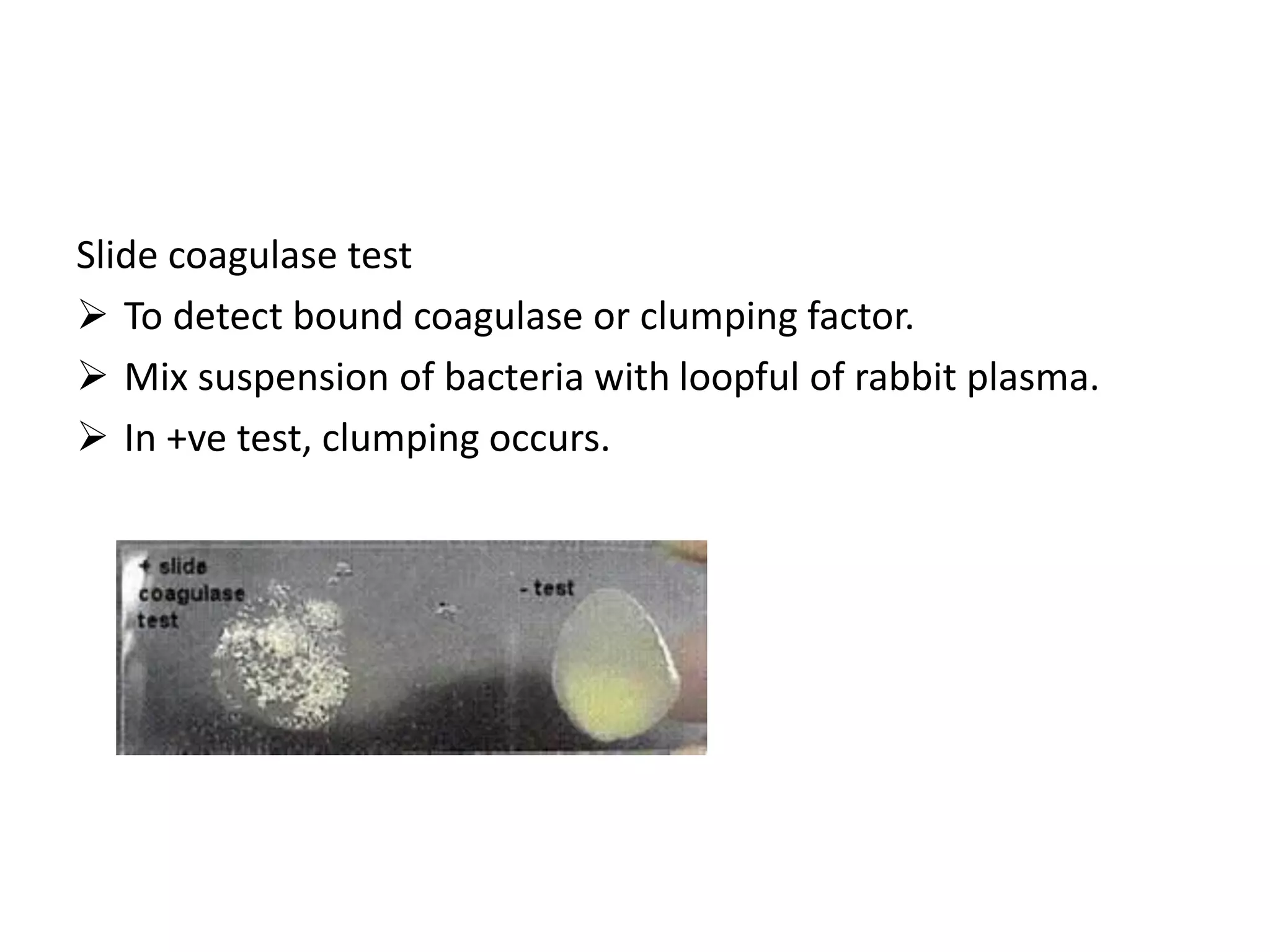 Slide coagulase test
➢ To detect bound coagulase or clumping factor.
➢ Mix suspension of bacteria with loopful of rabbit plasma.
➢ In +ve test, clumping occurs.
 