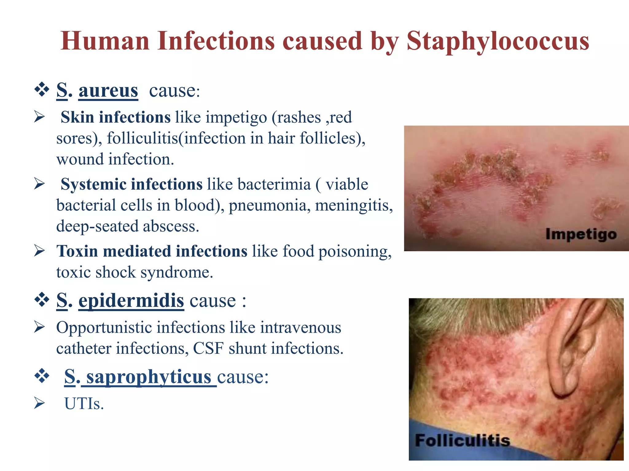 Human Infections caused by Staphylococcus
❖ S. aureus cause:
➢ Skin infections like impetigo (rashes ,red
sores), folliculitis(infection in hair follicles),
wound infection.
➢ Systemic infections like bacterimia ( viable
bacterial cells in blood), pneumonia, meningitis,
deep-seated abscess.
➢ Toxin mediated infections like food poisoning,
toxic shock syndrome.
❖ S. epidermidis cause :
➢ Opportunistic infections like intravenous
catheter infections, CSF shunt infections.
❖ S. saprophyticus cause:
➢ UTIs.
 