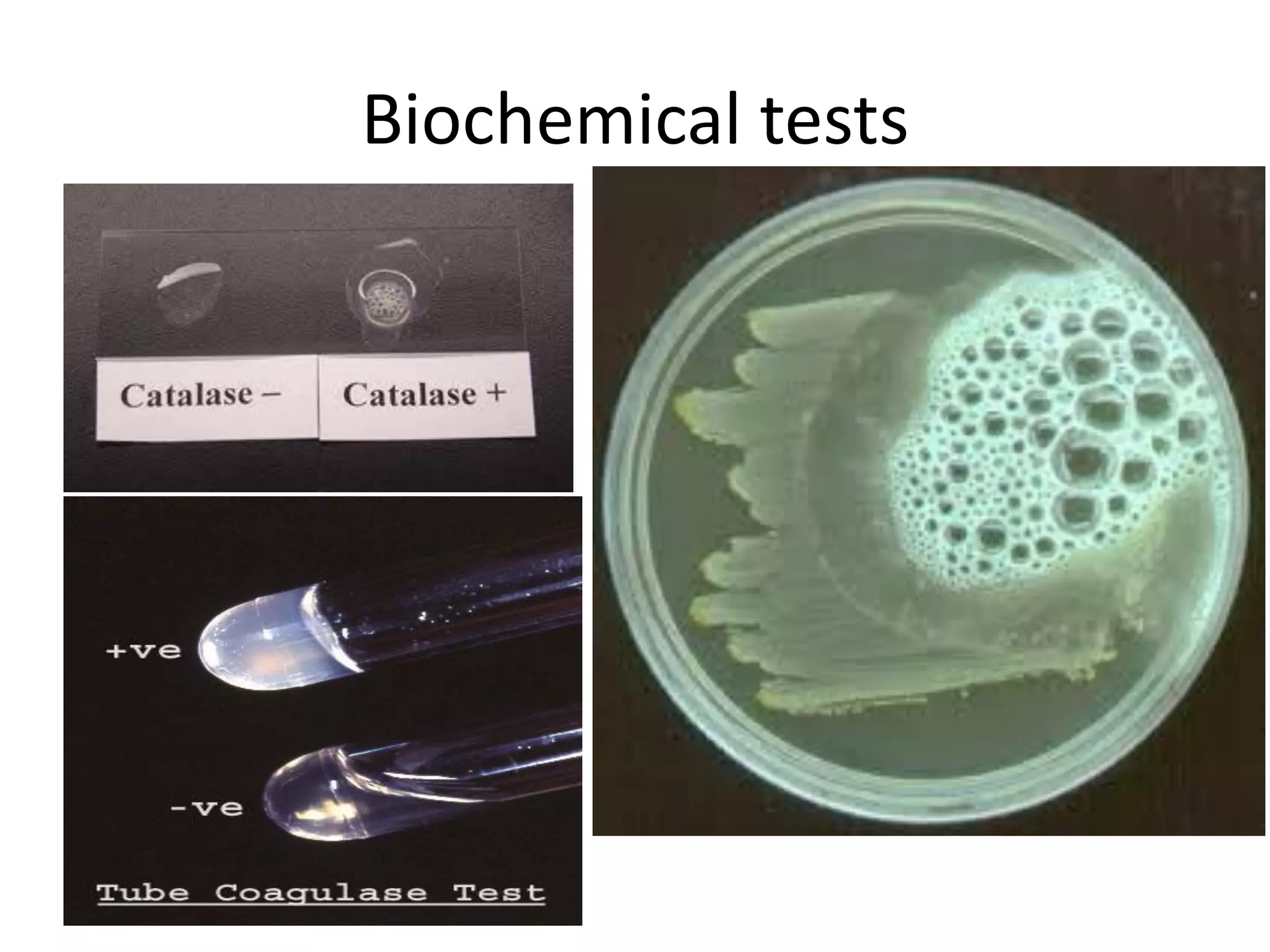 Biochemical tests
 