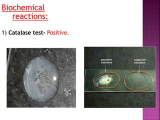 Biochemical
reactions:
1) Catalase test- Positive.
 