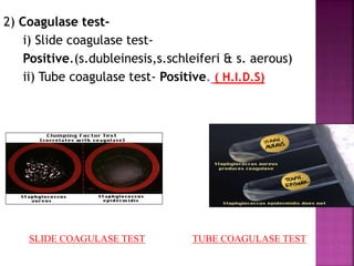 2) Coagulase test-
i) Slide coagulase test-
Positive.(s.dubleinesis,s.schleiferi & s. aerous)
ii) Tube coagulase test- Positive. ( H.I.D.S)
SLIDE COAGULASE TEST TUBE COAGULASE TEST
 