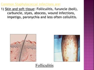 Common Staphylococcal infections are:
1) Skin and soft tissue: Folliculitis, furuncle (boil),
carbuncle, styes, abscess, wound infections,
impetigo, paronychia and less often cellulitis.
Folliculitis
Folliculitis
 
