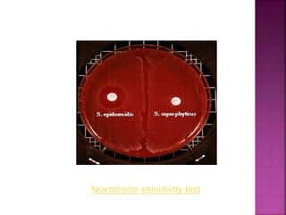 Novobiocin sensitivity test
 