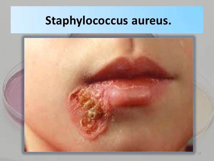 Atopichesky la dermatitis el ungüento eficaz