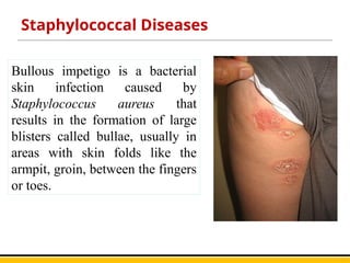 Staphylococcus aureus: Quick Overview.pptx
