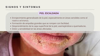 Stafilo Rinitas staphylococcus aureus - presentacion clinica | PDF