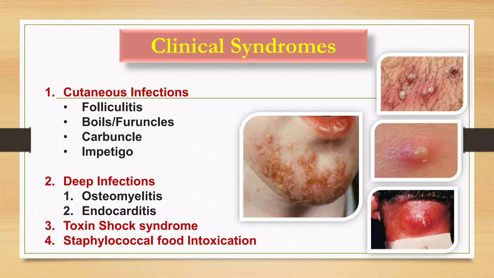 Clinical Syndromes
1. Cutaneous Infections
• Folliculitis
• Boils/Furuncles
• Carbuncle
• Impetigo
2. Deep Infections
1. Osteomyelitis
2. Endocarditis
3. Toxin Shock syndrome
4. Staphylococcal food Intoxication
 