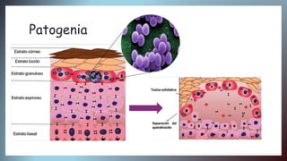 Staphylococcus hyicus veterinaria | PPTX