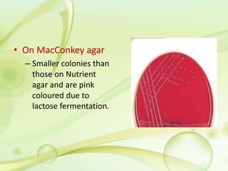• On MacConkey agar
– Smaller colonies than
those on Nutrient
agar and are pink
coloured due to
lactose fermentation.
 