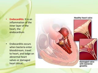 • Endocarditis: It is an
inflammation of the
inner layer of the
heart, the
endocardium
• Endocarditis occurs
when bacteria enter
bloodstream, travel
to heart, and lodge on
abnormal heart
valves or damaged
heart tissue.
 