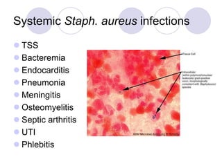 Systemic Staph. aureus infections
 TSS
 Bacteremia
 Endocarditis
 Pneumonia
 Meningitis
 Osteomyelitis
 Septic arthritis
 UTI
 Phlebitis
 