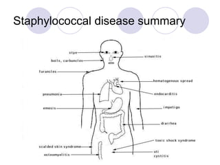 Staphylococcal disease summary
 