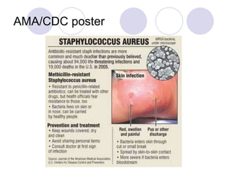 AMA/CDC poster
 
