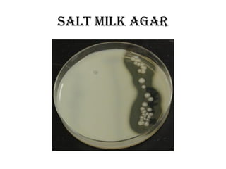 Salt milk agar
 
