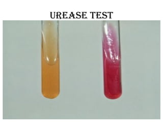 Urease test
 