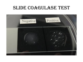 Slide coagulase test
 