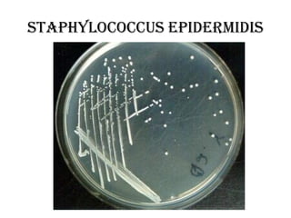 Staphylococcus epidermidis
 