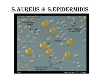 s.Aureus & S.epidermidis
 