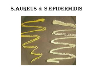 s.Aureus & S.epidermidis
 