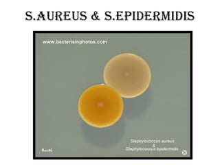 s.Aureus & S.epidermidis
 