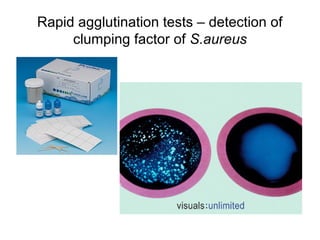 Staphylococcus streptococcus bacteriological diagnosis_i | PPT