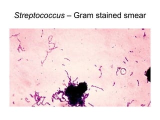 Streptococcus – Gram stained smear
 