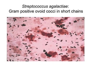 Streptococcus agalactiae:
Gram positive ovoid cocci in short chains
 