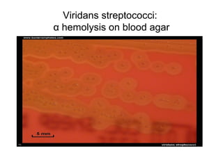 Viridans streptococci:
α hemolysis on blood agar
 