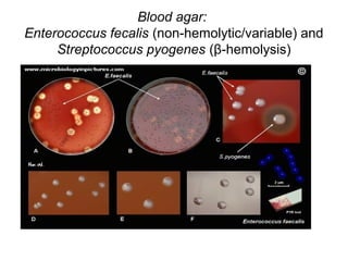 Blood agar:
Enterococcus fecalis (non-hemolytic/variable) and
Streptococcus pyogenes (β-hemolysis)
 