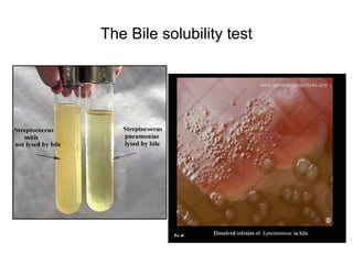 The Bile solubility test
 
