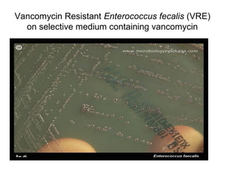 Vancomycin Resistant Enterococcus fecalis (VRE)
on selective medium containing vancomycin
 