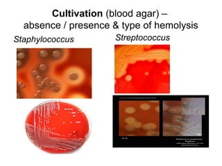 Cultivation (blood agar) –
absence / presence & type of hemolysis
Staphylococcus Streptococcus
 
