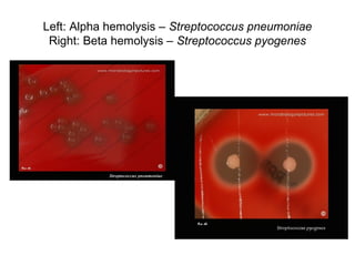 Left: Alpha hemolysis – Streptococcus pneumoniae
Right: Beta hemolysis – Streptococcus pyogenes
 